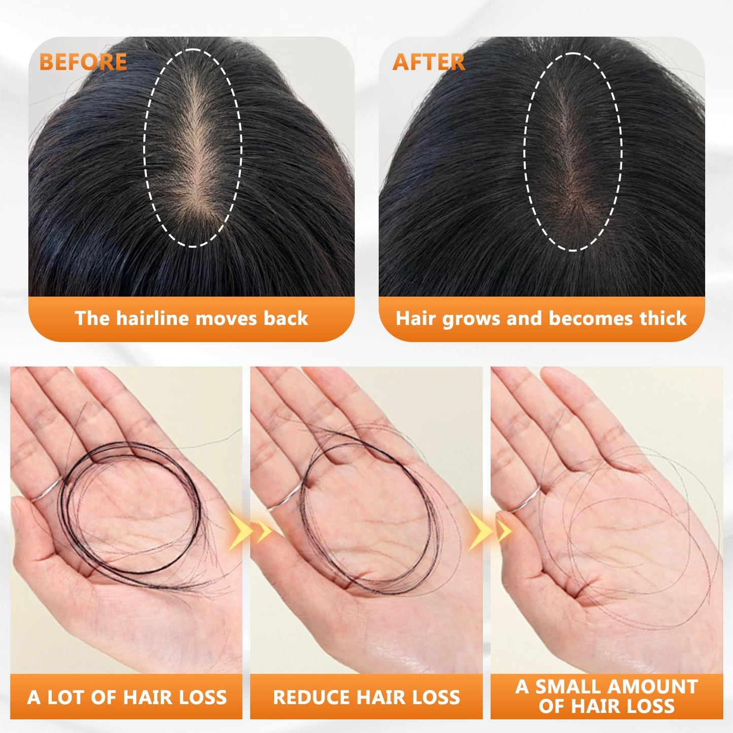 🔥【Buy 1 Get 1 Free】 Anti-Hair Fall Promote Hair Growth Shampoo, Routine Shampoo for Women Hair Loss, for All Hair Types(100ML)