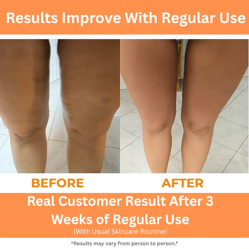 🔥Ring Leg Massager | 3-in-1 Deep Tissue Roller + Leg Toner + Pelvic Trainer!🔥
